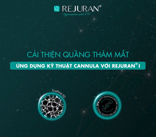 𝐑𝐄𝐉𝐔𝐑𝐀𝐍® 𝒊 | CẢI THIỆN QUẦNG THÂM, NẾP NHĂN VÀ GIẢM SƯNG VÙNG MẮT BẰNG KỸ THUẬT CANNULA